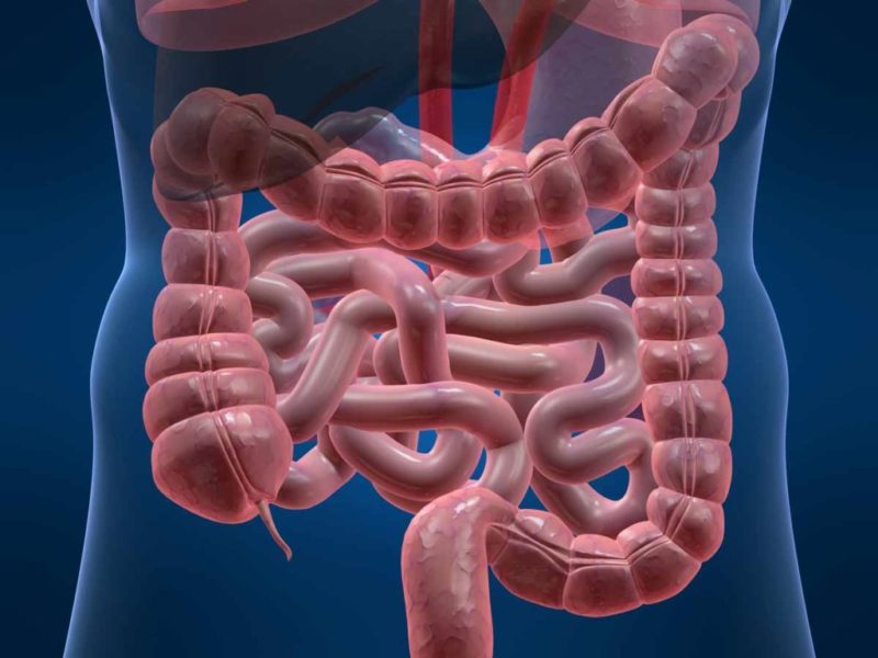 Noninfective enteritis and colitis